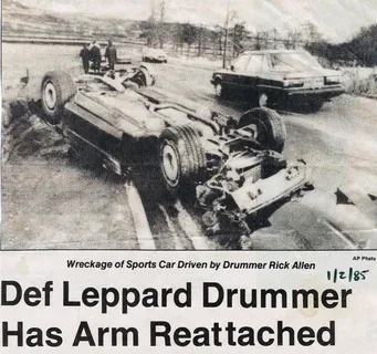 Def Leppard Drummer has arm reattached